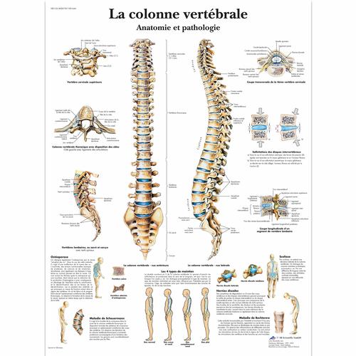 Lehrtafel - La colonne vertébrale, Anatomie et pathologie, 1001644 [VR2152L], Skelettsystem
