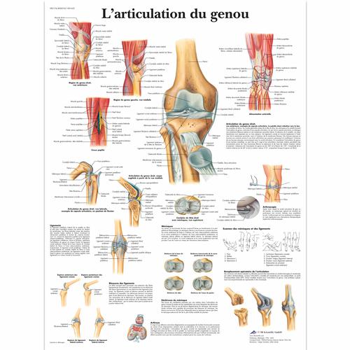 Lehrtafel - L'articulation du genou, 1001652 [VR2174L], Skelettsystem