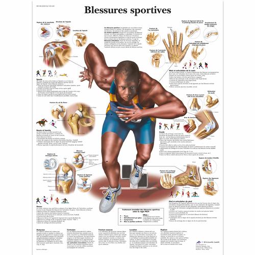 Blessures sportives, 4006746 [VR2188UU], Muscle