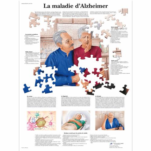 PM La maladie d'Alzheimer, 1001760 [VR2628L], 大脑和神经系统