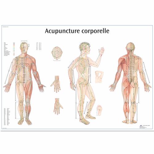Lehrtafel - Acupuncture corporelle, 1001795 [VR2820L], Akupunktur Modelle und Lehrtafeln
