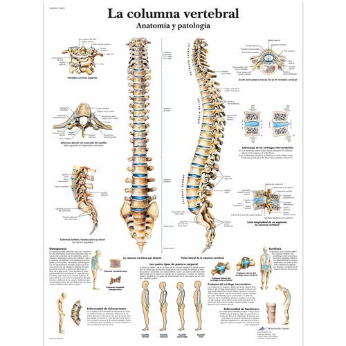La columna vertebral - Anatomía y patología, 1001811 [VR3152L], Sistema Esquelético