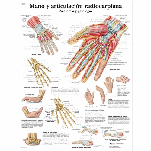Mano y articulación radiocarpiana - Anatomía y patología, 1001815 [VR3171L], Skeletal System