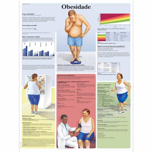 Obesidad - adiposidad, 4006859 [VR3460UU], Sistema metabólico