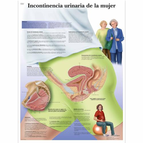 Incontinencia urinaria de la mujer, 4006864 [VR3542UU], Gynaecology