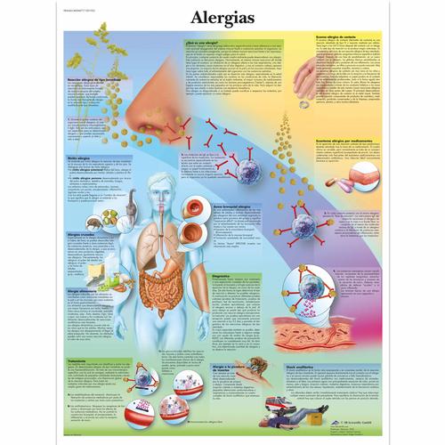 Alergias, 4006877 [VR3660UU], Sistema inmunitario