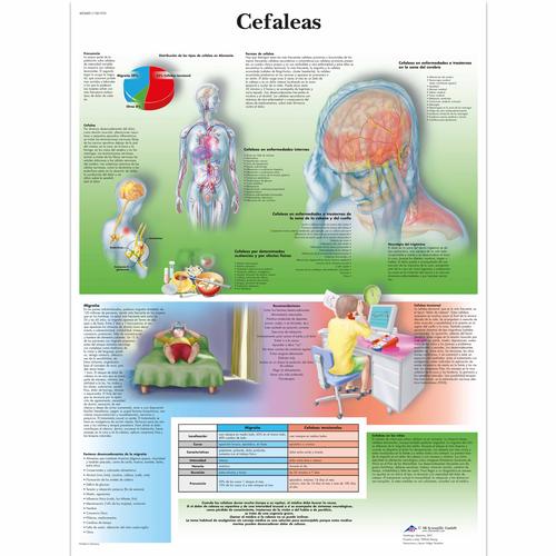 Cefaleas, 4006881 [VR3714UU], Cerebro y sistema nervioso