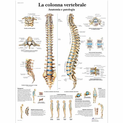 La colonna vertebrale, anatomia e patologia, 1001977 [VR4152L], système Squelettique