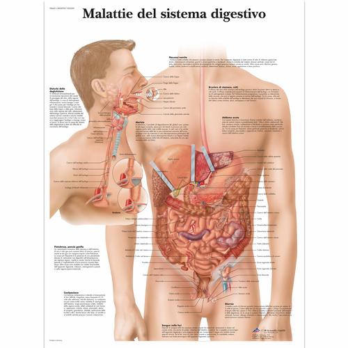 Malattie del sistema digestívo, 1002049 [VR4431L], Emésztőrendszer