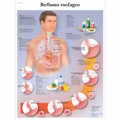 Reflusso esofageo, 1002106 [VR4711L], El sistema digestivo