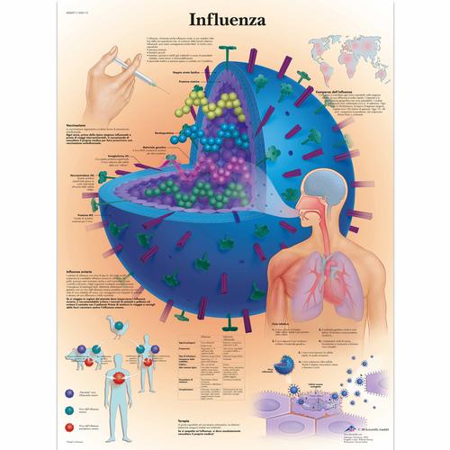 Lehrtafel - Influenza, 1002112 [VR4722L], Parasitäre, virale oder bakterielle Infektion