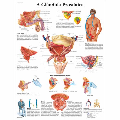 A glândula Prostatica, 50x67 cm, Versao Papel, 4007002 [VR5528UU], Sistema Urinario