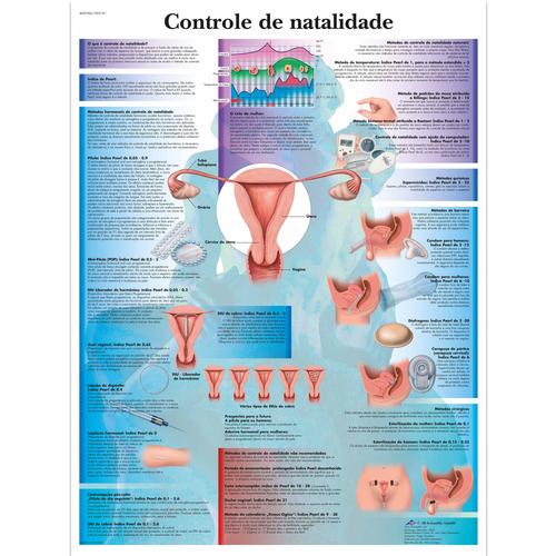 Controle de natalidade, 50x67 cm, Versao Papel, 4007006 [VR5591UU], Gynaecology
