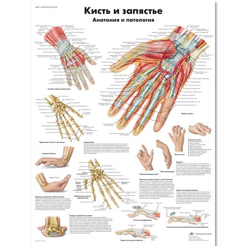Медицинский плакат "Кисть и запястье, анатомия и патология", 1002226 [VR6171L], Skelettsystem