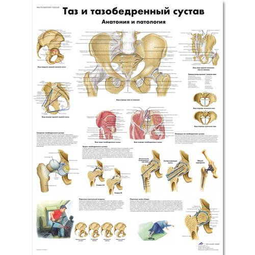 Медицинский плакат "Таз и тазобедренный сустав, анатомия и патология", 1002228 [VR6172L], Плакаты по опорно-двигательному аппарату человека