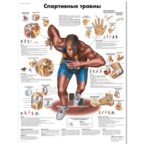 Медицинский плакат "Спортивные травмы", 1002236 [VR6188L], Muskel
