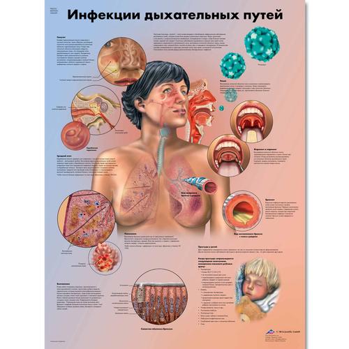 Медицинский плакат "Инфекции дыхательных путей", 1002249 [VR6253L], Système Respiratoire