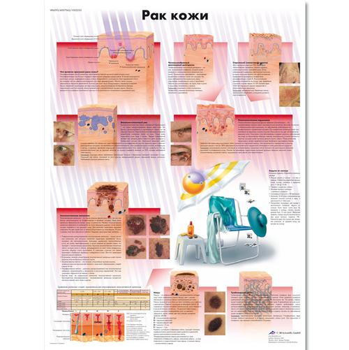 Skin Cancer Chart, 1002255 [VR6295L], Cancers