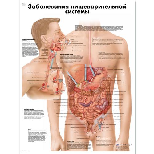 Медицинский плакат "Заболевания пищеварительной системы", 1002290 [VR6431L], Système digestif
