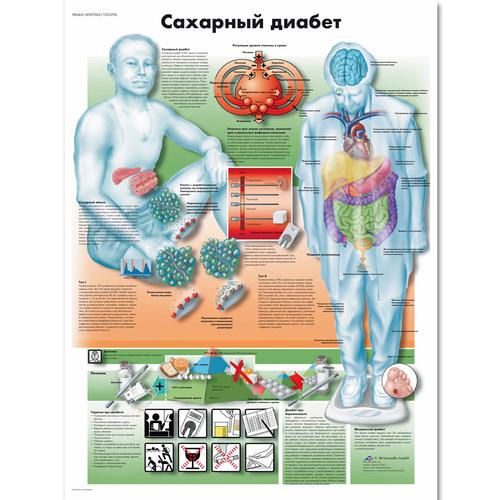 Diabetes mellitus Chart, 1002296 [VR6441L], Metabolikus rendszer
