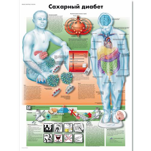 Медицинский плакат "Сахарный диабет", 1002296 [VR6441L], Stoffwechselsystem