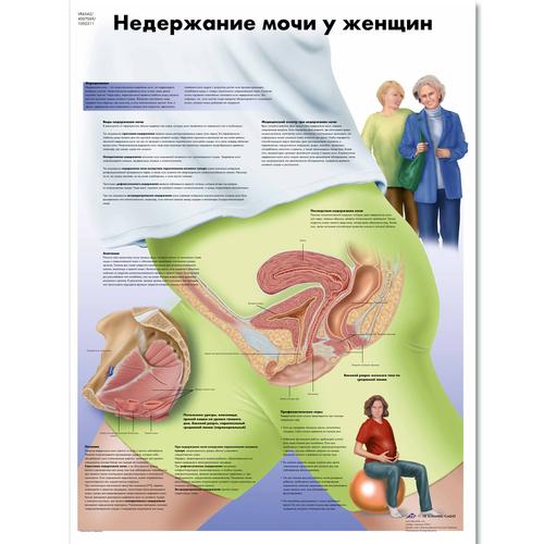 Медицинский плакат "Недержание мочи у женщин", 1002311 [VR6542L], Плакаты по гинекологии
