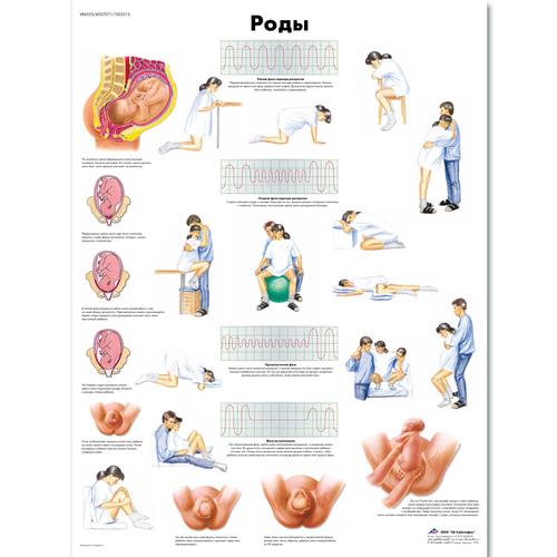 Медицинский плакат "Роды", 1002315 [VR6555L], Плакаты по беременности и родам