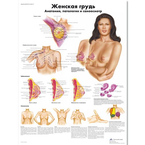 Медицинский плакат "Женская грудь, анатомия, патология и самоосмотр", 1002317 [VR6556L], Плакаты по гинекологии