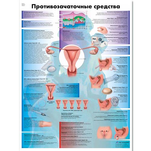 Медицинский плакат "Противозачаточные меры", 1002321 [VR6591L], Ginecologia
