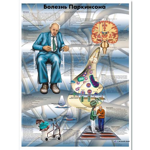 Parkinson's Disease Chart, 1002335 [VR6629L], Brain and Nervous system