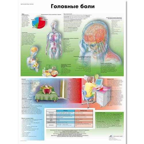 Медицинский плакат "Головные боли", 1002345 [VR6714L], Cervello e del sistema nervoso