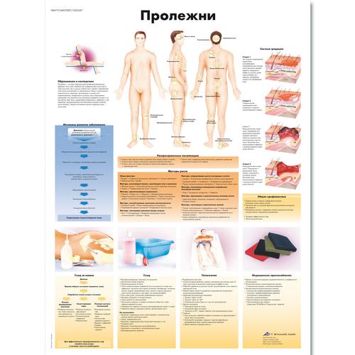 Медицинский плакат "Пролежни", 1002347 [VR6717L], Pelle