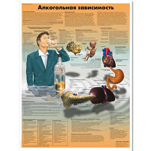 Медицинский плакат "Акогольная зависимость", 1002361 [VR6792L], Sucht