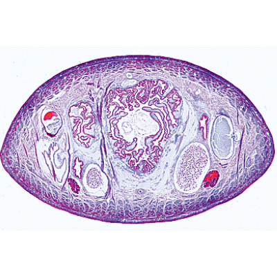 Vermes (Helminthes) - Fran&ccedil;ais, 1003856 [W13003F], Lames microscopiques Fran&ccedil;ais