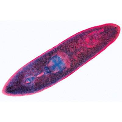 Vermes (Helminthes) - Espagnol, 1003858 [W13003S], Lames microscopiques Espagnol