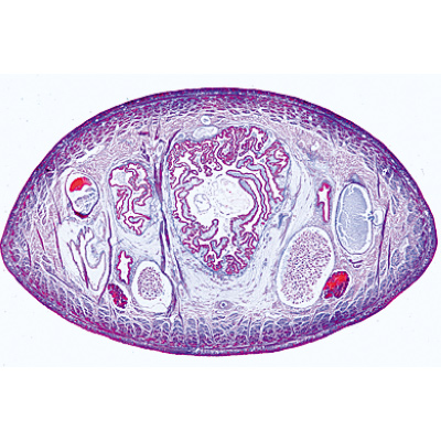 Vermes (Helminthes) - Espagnol, 1003858 [W13003S], Lames microscopiques Espagnol