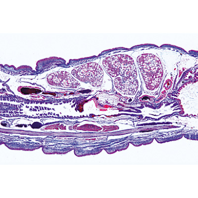Vermes (Helminthes) - Espagnol, 1003858 [W13003S], Lames microscopiques Espagnol