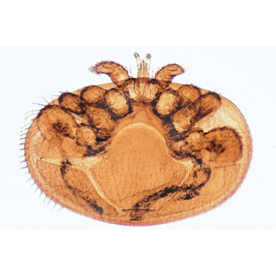 Arachnides et myriapodes - Français, 1003864 [W13005F], Préparations microscopiques LIEDER