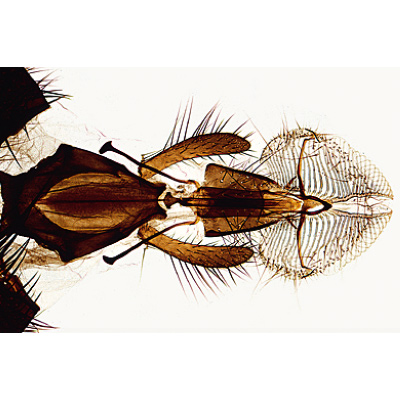 Insectes, s&eacute;rie &eacute;l&eacute;mentaire grossie - Allemand, 1003867 [W13006], Lames microscopiques Allemand