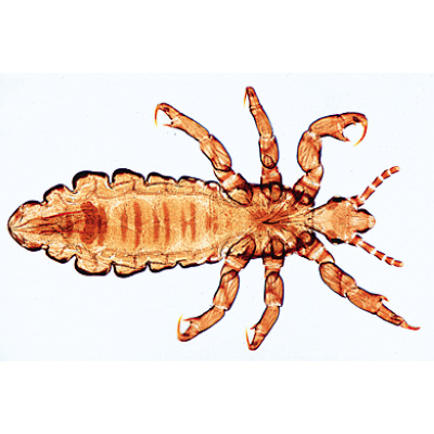 Насекомые (Insecta). На португальском языке, 1003869 [W13006P], Микроскопы Слайды LIEDER