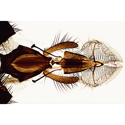Insectes, s&eacute;rie &eacute;l&eacute;mentaire grossie - Espagnol, 1003870 [W13006S], Lames microscopiques Espagnol