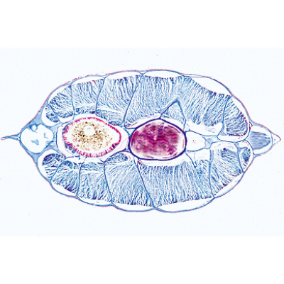 C&eacute;phalocord&eacute;s (Acrania) - Portugais, 1003881 [W13009P], Lames microscopiques Portugais