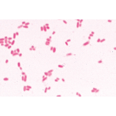 Baktérium alapkészlet -Francia nyelvű, 1003885 [W13011F], LIEDER mikrometszetek