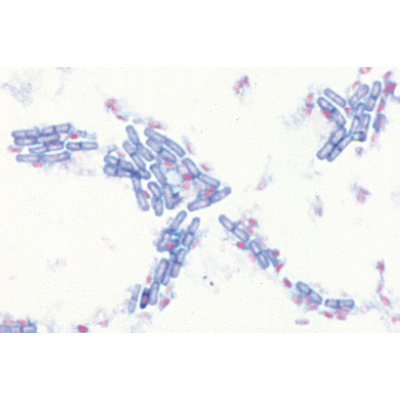 Bacteria, Basic Set - French, 1003885 [W13011F], 현미경 슬라이드 LIEDER