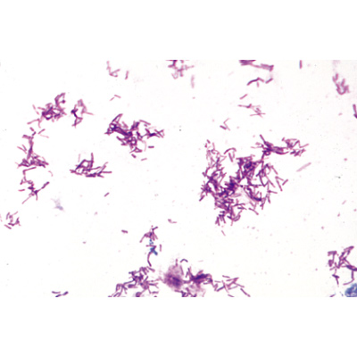 Bacteria, Basic Set - French, 1003885 [W13011F], 현미경 슬라이드 LIEDER