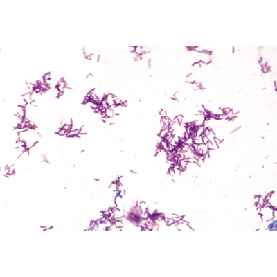 S&eacute;rie de base de bact&eacute;ries - Portugais, 1003886 [W13011P], Lames microscopiques Portugais