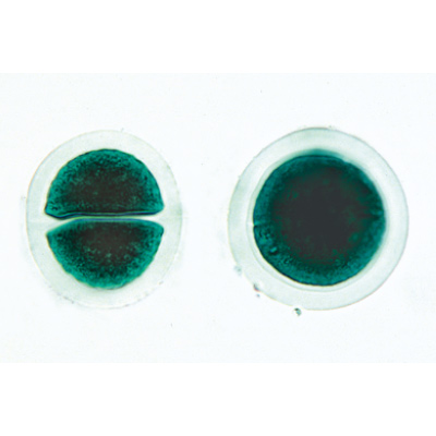 Algae - German Slides, 1003888 [W13012], 현미경 슬라이드 LIEDER