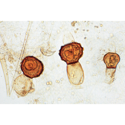 Pilze und Flechten (Fungi, Lichenes), Almanca (20'li), 1003892 [W13013], Mikroskop Kaydırıcılar LIEDER