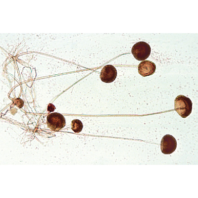 Champignons et lichens - Allemand, 1003892 [W13013], Lames microscopiques Allemand