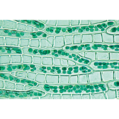 Bryophytes (sphaignes et mousses) - Allemand, 1003896 [W13014], Lames microscopiques Allemand
